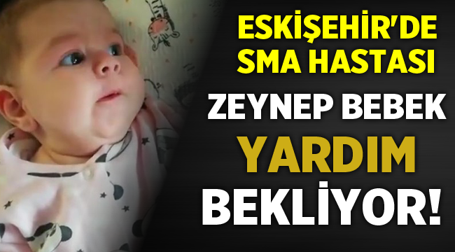 Eskişehir'de SMA hastası Zeynep Bebek destek bekliyor