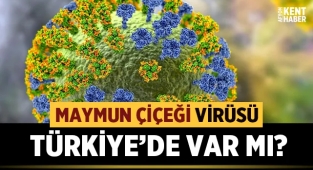Maymun çiçeği virüsü Türkiye'de görüldü mü?