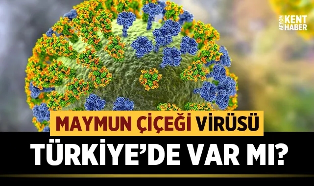 Maymun çiçeği virüsü Türkiye'de görüldü mü?