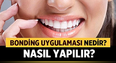 Bonding Uygulaması Nedir? Nasıl Yapılır?