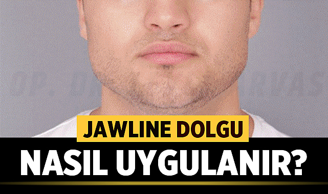 JAWLINE DOLGU NASIL UYGULANIR?