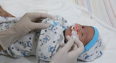 Dokuz Eylül dudak yarığı tedavisinde umut oluyor