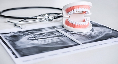 Kanal Tedavisi Acılı mı Olur?