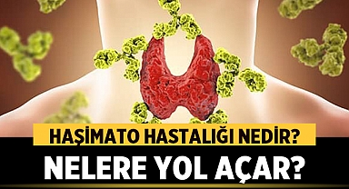 Haşimato Hastalığı Nedir, Nelere Yol Açar, Nasıl Anlaşılır? Tedavisi