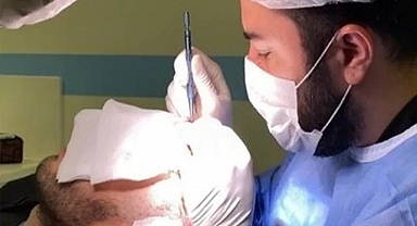 Million Hair Center: Saç Ekiminde Sapphire Fue Yöntemi