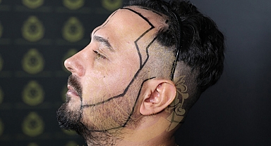 Hair Center of Turkey Güvencesiyle Sakal Ekimi