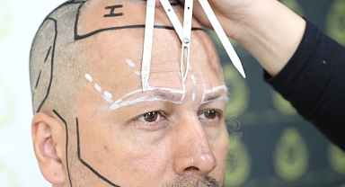 Hair Center of Turkey Kaş Ekimi: Kaş Dökülmelerinde Kalıcı Çözüm