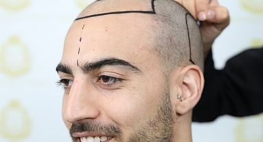 Hair Center of Turkey: Saç Ekiminde Teknoloji ve İnovasyon Arada