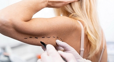 Liposuction Vücuttaki Fazla Yağları Giderin 