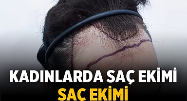 Kadınlarda Saç Ekimi