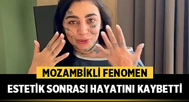 Mozambikli Fenomen Ana Bárbara Estetik Sonrası Hayatını Kaybetti