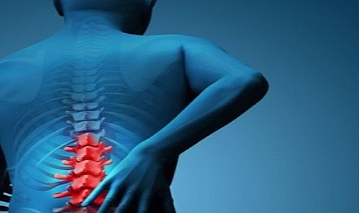 Lomber Dar Kanal: Belirti, Teşhis ve Tedaviye Net Bakış