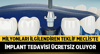 Milyonları İlgilendiren Teklif Meclis'te: İmplant Tedavisi Ücretsiz Oluyor