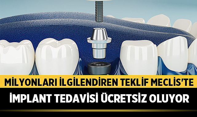 Milyonları İlgilendiren Teklif Meclis'te: İmplant Tedavisi Ücretsiz Oluyor